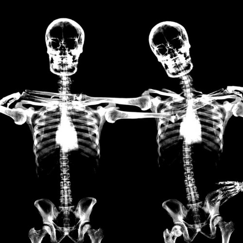 HCM- Synthesized Brain