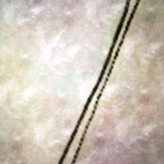 Uncertain figure
