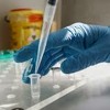 Результати тестів на COVID-19 в різних лабораторіях можуть бути різними, і це нормально — Скавронський Результати тестів на COVID-19 в різних лабораторіях можуть бути різними, і це нормально — Скавронський