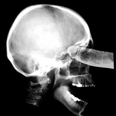 Total Resistance - Kaos - Brain Rape 1 B