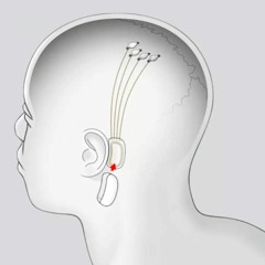 Confused (intermission)