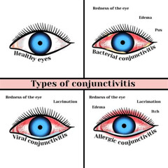 Best Viral Infection In Eye Treatment Reviews