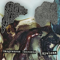 "Dismemberment Session"