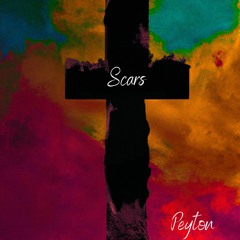 Scars