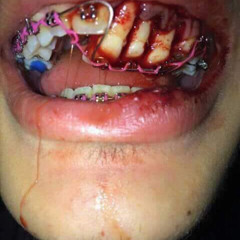 CINDY (beat prod. chaggas + gleero)