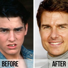 IM SO GUTTER (Before & After)