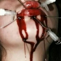 Revenge