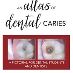 [GET] KINDLE 🗃️ An Atlas of Dental Caries: A Pictorial For Dental Students and Denti