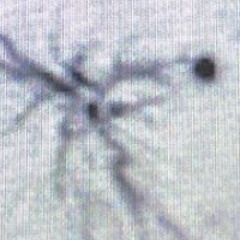 medulla