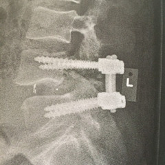 Too Much Noisia on the Bus, time for a Plan-B