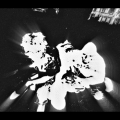 vertigo