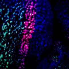 Love , unconditional