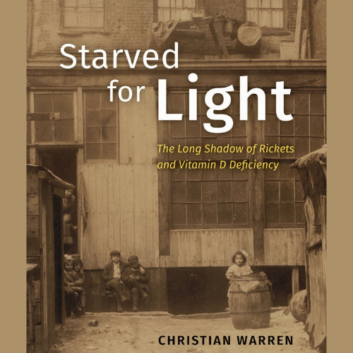 Starved for Light: The Long Shadow of Rickets and Vitamin D Deficiency (Sample)