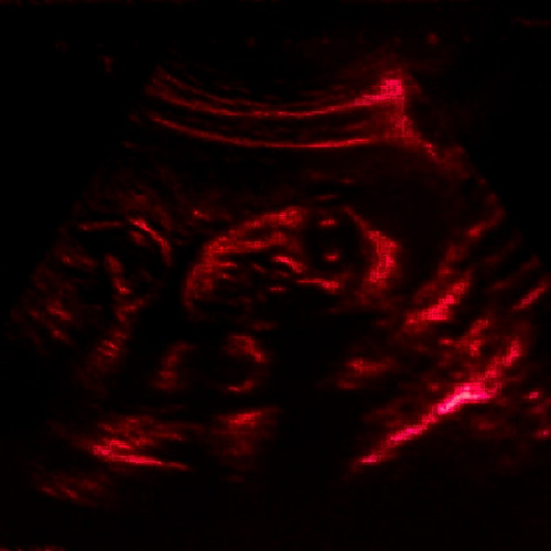 *HARD* Deadly Eye (Lil Darkie x scarlxrd Type Beat)