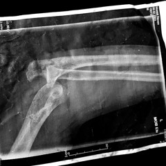 Schmerzpatient ( ONE PATTERN )