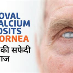 Best Calcium Deposits On Eyes Treatment Reviews
