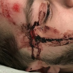 MENTAL TRAFFICK (Prod. BexBlu)