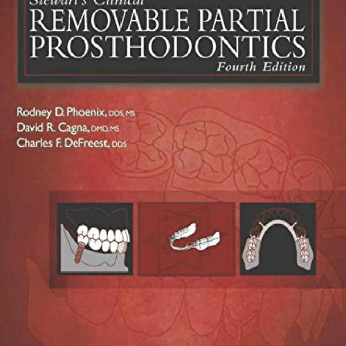 Stream [PDF] Stewart's Clinical Removable Partial Prosthodontics, 4th