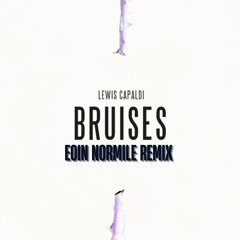 Lewis Capaldi-Bruises (Eoin Normile Remix)