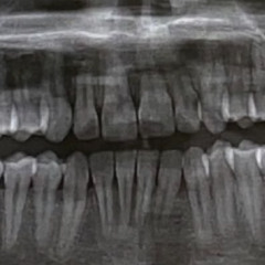 Dental (prod 2lz x wtm)