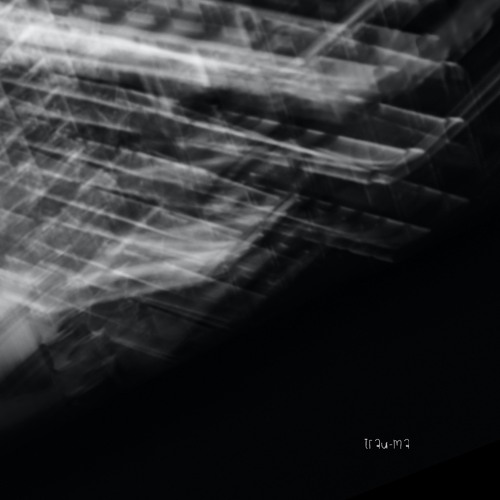 Lost In Ether | P R E M I E R E | Goldzik - Phantom [trau-ma]