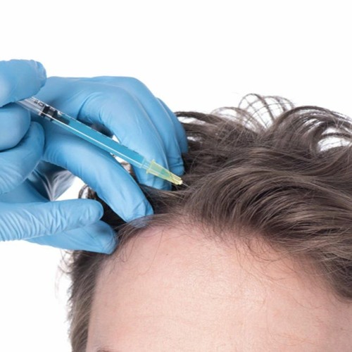 PRP/GFC Therapy  लेने से पहले किन - किन बातो का ध्यान रखें    Hair PRP Treatment In Delhi NCR