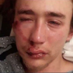 Chelsether (Kavan Merrill Diss) (Prod. Ron Browz)