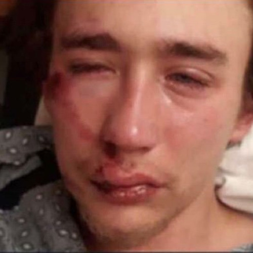 Chelsether (Kavan Merrill Diss) (Prod. Ron Browz)