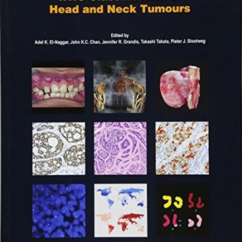 download KINDLE 💗 WHO Classification of Head and Neck Tumours (WHO Classification of