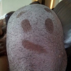 Ashy Knees and Quarantine