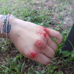 I Hope Your Okay Part 2 x TFG