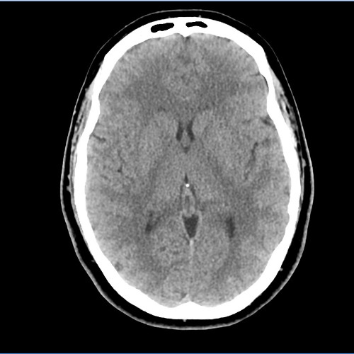 Senza mezzo di contrasto