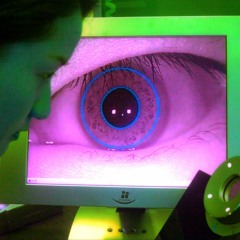Globe Optic