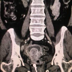 ozzy kk + metro xo + glory xo - cervix (pandhergbp + dvtchy) [slump audios + 8teen + v8gve]