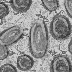 virus
