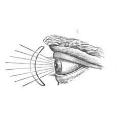 Moser - Unknown 001