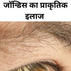 Natural treatment of jaundice