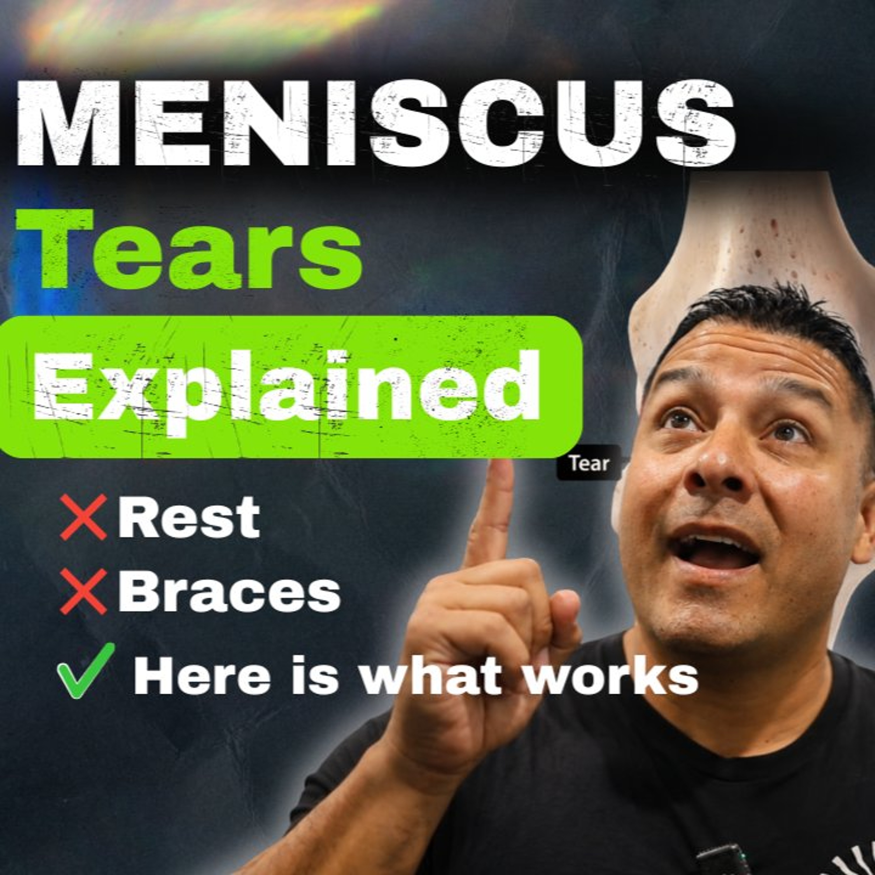 Podcast EP146 | Why Rest Doesn't Heal a Meniscus Tear episode artwork