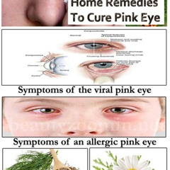 Best Home Treatment Pink Eye Reviews