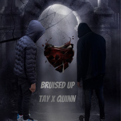 Brusied up Remix