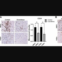 Everolimus Inhibits Angiogenesis, Lymphangiogenesis in TP53 Mutant HNSCC