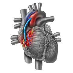 CABG, 1st Edition