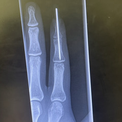 Mind Playing Tricks on Me Freestyle