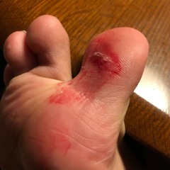 serious injury