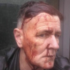 Co Leitrim protester relives physical attack at weekend demonstration