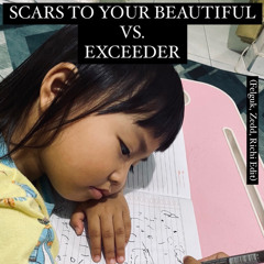 Alessia Cara & Mason - Scars To Your Beautiful x Exceeder (Felguk, Zedd, Richi Edit)