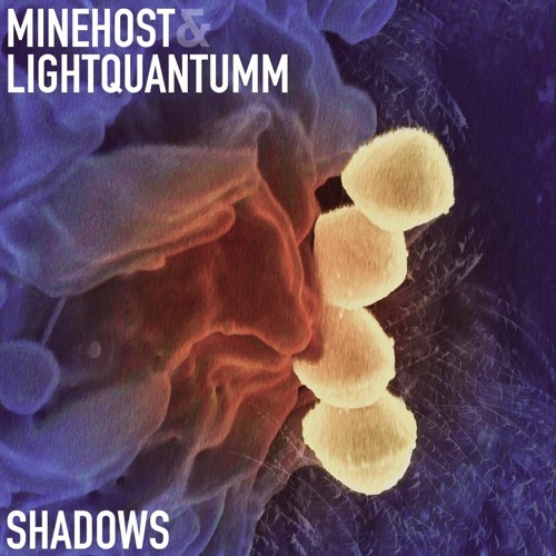 Minehost X Lightquantumm – Shadow
