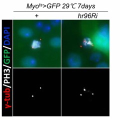 The Anti-aging Effect of Vitamin D and its Receptor in Drosophila Midgut