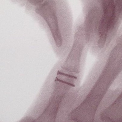 No Future Just Trance