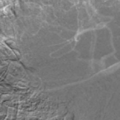 Trans Cerebral Express